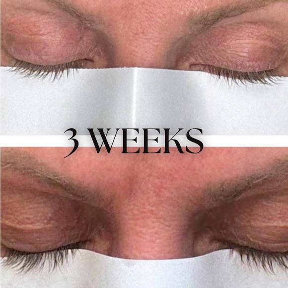 Eyelash Growth Serum Results - Picture 4 of 8